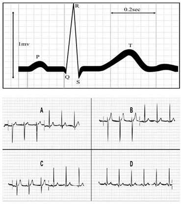 ""NCERT-Solutions-Class-9-Science-Chapter-12-Sound-1