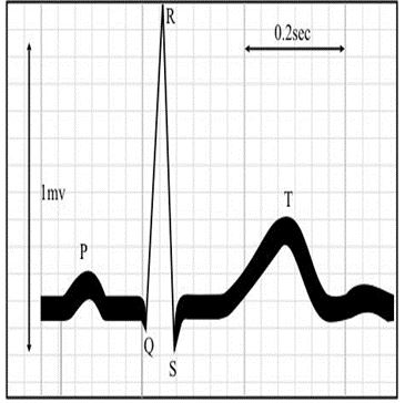 ""NCERT-Solutions-Class-9-Science-Chapter-12-Sound-2